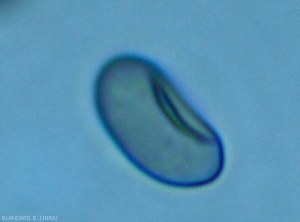 Detalle de una espora madura de <i> Pilidiella diplodiella </i>.  La estructura globular central corresponde en realidad a una depresión local de la espora.