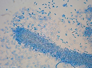 Aspecto al microscopio óptico de un cirro de esporas alfa de <b><i>Phomopsis viticola</i></b>.