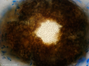 Detalle de picnidios de <b> <i> Phomopsis viticola </i> </b>.  Podemos ver claramente el ostiolo y la masa de conidios hialinos dentro de esta estructura. 