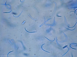 Aspecto al microscopio óptico de un cirro de esporas beta de <b> <i> Phomopsis viticola </i> </b>.