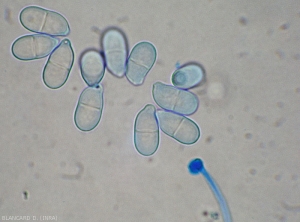 Aspecto de varios conidios hialinos y bicelulares ubicados cerca del final de un conidióforo de <i> <b> Trichothecium roseum </b> </i>. 