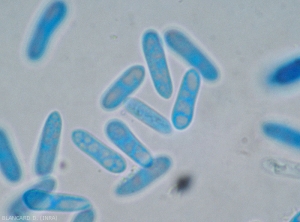 Detalle de conidios hialinos y más o menos gutulados de <i><b> Colletotrichum </i></b> sp.  