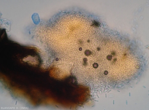 Aparición de un acérvulo en corte en el que se distinguen las numerosas conidias formadas que quedan aglomeradas en masa. <b> <i> Colletotrichum </i></b> sp. 