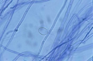 Esporangio globular de <b><i>Pythium</i> sp.</b> ("damping-off")