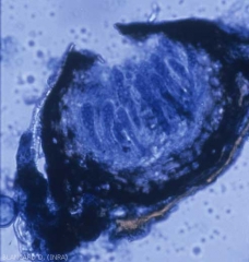 Los peritecios de <b> <i> Guignardia bidwellii </i> </b> que se abren con un ostiolo plano, carecen de paráfisis y contienen ascos en los que se forman ascosporas de reproducción sexual.