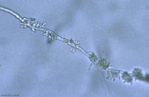 Los blastoconidios de <i> <b> Aureobasidium pullulans </b> </i> se producen en un mechón de dentículos.
