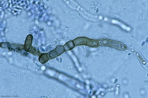 Estas hifas de <b> <i> Aureobasidium pullulans </i> </b> se van melanizando gradualmente para finalmente dar lugar a artroconidios.