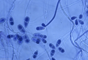 Los conidios de <i> <b> Trichothecium roseum </b> </i> son hialinos y bicelulares.  (moho rosa)