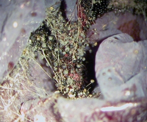 Los esporangios erectos que contienen las esporangiosporas (cabezas de alfiler) son claramente visibles en el corazón de las uvas podridas.  Estas esporangiosporas aseguran fácilmente la diseminación de este hongo.  <i> <b> Rhizopus stolonifer </b> </i>