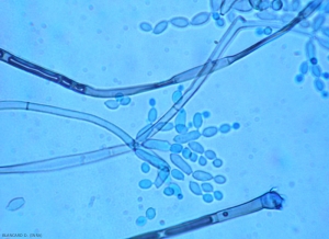 Este conidióforo de <b> <i> Cladosporium </i> sp. </b> en crecimiento simpodial tiene conidios ovoides a alargados.