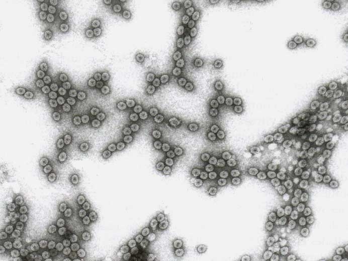 Particules virales parasphériques d'environ 29 nm de diamètre. <b>Virus de la mosaïque du concombre</b> (<i>Cucumber mosaic virus</i>, CMV)