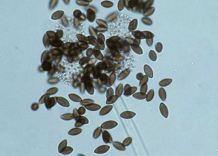 Aspect au microscope photonique des spores brunes, fusiformes et striées de <i><b>Choanephora cucurbitarum</b></i>.
