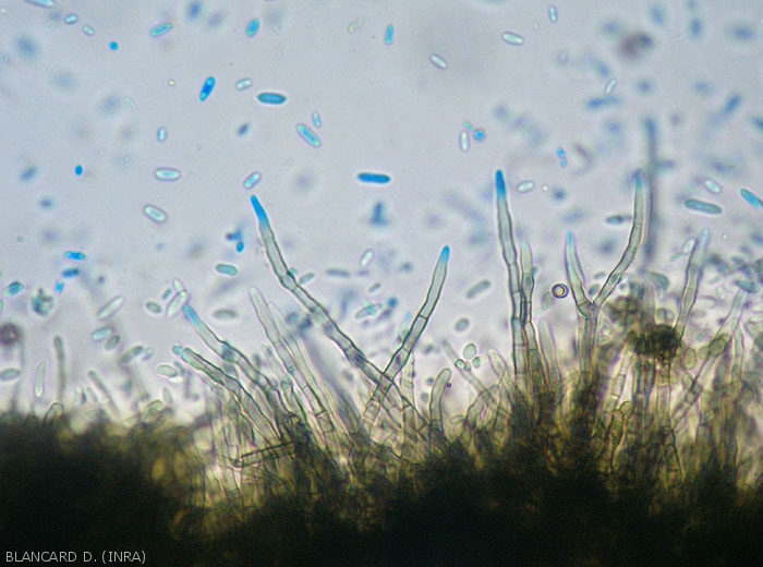 De nombreux conidiophores bruns à noirâtres sont dressés à la surface de ces tissus. (pourriture à <i>Cladosporium</i>) 