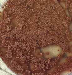 Aspect sur milieu nutritif en boîde de Petri des colonies d'<b><i>Elsinoë ampelina</i></b>, agent de l'anthracnose de la vigne.