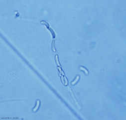Huit ascospores hyalines et arquées sont visibles dans un asque d'<i><b>Eutypa lata</b></i> (eutypiose)