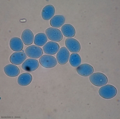 Aspect de plusieurs sporanges ovoïdes à piriformes de <b><i>Plasmopara viticola</i></b>. (mildiou)