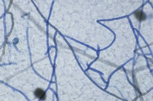 Le mycélium des champignons phytopathogènes tels que les ascomycètes et les basidiomycètes (ici <i>Rhizoctonia solani</i>), est <b>cloisonné</b>.