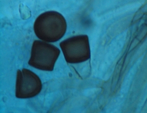 Aspect de quelques chlamydospores désarticulées et brun sombre de <i><b>Thielaviopsis basicola</b></i>. (pourriture noire)