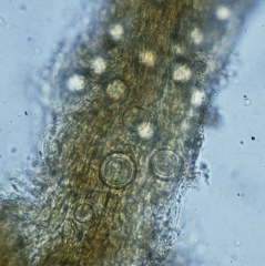 Des oospores de <b><i>Pythium aphanidermatum</i></b> sont bien visibles dans les tissus de cette racine plus ou moins pourrie. (oomycète)