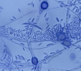 <b><i>Fusarium oxysporum</i> f. sp. <i>melonis</i></b> forme des macro et des microconidies, ainsi que des chlamydospores qui assurent sa dissémination et sa conservation. (fusariose)