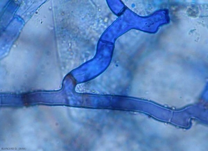 On note également sur le mycélium de <i>Rhizoctonia solani</i>  une légère constriction au niveau des ramifications latérales, ainsi que la présence de cloisons.