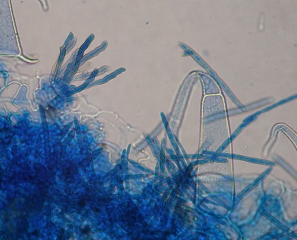 Plusieurs conidiophores émergeant d'un stomate et des conidies sont présents sur cette portion de feuille observée au microscope photonique.
<i>Pseudocercospora fuligena</i> (cercosporiose)