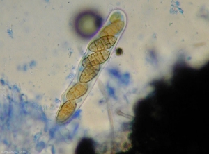 Un asque contenant huit ascospores pluricellulaires a été sorti d'un périthèce mature de <i>Pleospora</i> sp.
