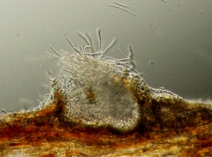 Une pycnide mature de <i>Septoria lycopersici</i> ; de nombreuses conidies ont été formées. (septoriose, Septoria leaf spot)(BRUCE-WATT - University of Maine)