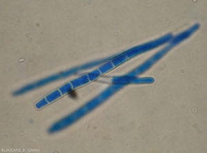 Détail au microscope photonique des conidies allongées et cloisonnées d'un <i>Cercospora</i> sp. observé sur feuille d'aubergine. (cercosporiose)