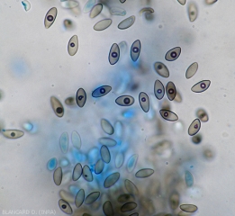 Aspect au microscope photonique de spores matures de <i><b>Pilidiella diplodiella</b></i>. Notez leur teinte brune et la présence d'une "structure globuleuse centrale" (rot blanc - white rot).