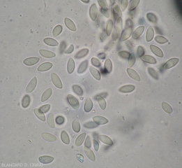 Aspect au microscope photonique de jeunes spores de <i><b>Pilidiella diplodiella</i></b> (rot blanc - white rot).