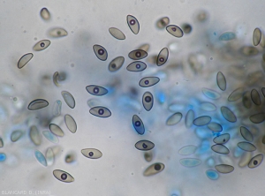 Aspect au microscope photonique de spores matures de <i><b>Pilidiella diplodiella</b></i>. Remarquez leur teinte brune et la présence d'une "structure globuleuse centrale".(rot blanc - white rot)