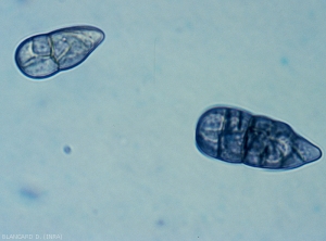 Les conidies de <b><i>Stemphylium solani</i></b> sont également mûriformes, brunes et disposent d'un apex pointu (parfois excentré) et d'une paroi verruqueuse. Elles révèlent moins de constrictions, une à deux, et sont plus courtes (63-52 x 14-20 µm) que celles de <i>S. floridanum</i>. Cette espèce ne possède pas non plus de forme sexuée. (Stemphyliose - grey leaf spot)