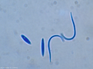 Les pycnides (a) de <b><i>Phomopsis viticola</i></b> produisent deux sortes de conidies : les spores alpha  ovoïdes à fusoïdes et les spores béta, filiformes et arquées.