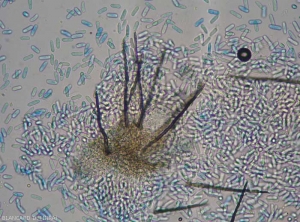 Cette acervule, dotée de plusieurs soies brunes à noirâtres cloisonnées, et entourées de nombreuses conidies hyalines. <i><b>Colletotrichum</i> sp</b>. (ripe rot)