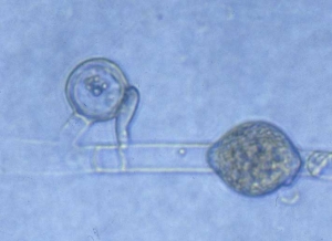 Oogone lisse fécondée par une anthéridie,  hyphal swelling  intercalaire. <b><i>Pythium</i> sp.</b> ("damping-off")
