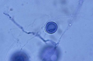 Ses oogones sont sphériques, à paroi lisse, souvent fécondées par 1 à 2 anthéridies le plus souvent monoclines (14-17 µm). Elles donnent lieu à des oospores plérotiques à paroi épaisse. <b><i>Pythium tracheiphilum</i></b> ("lettuce stunt")
