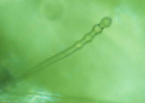 Détail d'un jeune conidiophore produisant ses premières conidies. <b><i>Golovinomyces cichoracearum</i> var. <i>cichoracearum</i></b> (oïdium, "powdery mildew")
