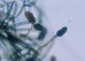 Quelques conidies pluricellulaires et muriformes se forment à l'extrémité de conidiophores enflés à leur extrémité. Par la suite, ces spores brunissent progressivement. <b><i>Stemphylium botryosum</i> f. <i>lactucum</i></b> (stemphyliose, "<i>stemphylium</i> leaf spot")
