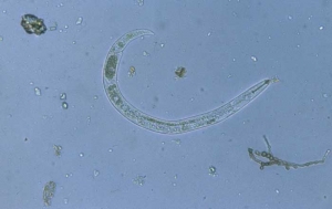 Les <i>Paratylenchus</i> sont des nématodes disposant  d'un long stylet buccal bien visible. <b><i>Paratylenchus sp.</i></b>