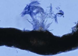 Sur cette feuille en coupe, on distingue bien un bouquet de spores filiformes sortant progressivement d'une pycnide. <b><i>Septoria lactucae</i></b> (septoriose, "<i>Septoria</i> leaf spot")