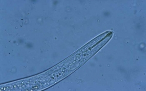 Le stylet de ce nématode adulte est particulièrement bien visible. <b><i>Paratylenchus</i> sp.</b> ("lesion nematodes")