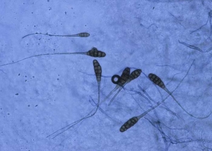 Plusieurs spores pluricellulaires, brunes et en forme de massue, sont dotées de cloisons transversales et longitudinales. Elles sont prolongées par un bec hyalin. <b><i>Alternaria cichorii</i></b> (alternariose, <i>Alternaria</i> leaf spot)