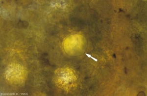 Les oospores à paroi épaisse (20-120 µm de diamètre) de <i>Plasmopara viticola</i> peuvent être observées dans les tissus contaminés en fin de saison. Elles ont une couleur jaune et matérialisent la reproduction sexuée du <b>Mildiou de la vigne</b>.
