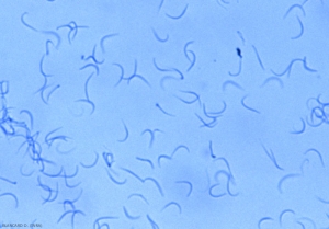 Les spores Beta de <b><i>Phomopsis viticola</i></b> sont longues, filiformes et arquées.