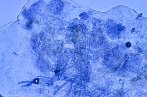 Lorsqu'il a pénétré sous la pellicule de la baie, <b><i>Botrytis cinerea</i></b> forme des agrégats de mycélium. 