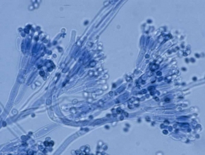 Mazzo di conidiofori a tre rami di <i><b>Penicillium expansum</b></i> .