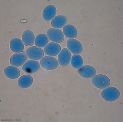 Aspetto di numerosi sporangi da ovoidali a piriformi di <b> <i> Plasmopara viticola </i> </b>. 