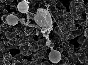 Tre zoospore sono germinate vicino allo sporangio da cui si sono formate e poi liberate.  (vista al microscopio a scansione) <i><b> Plasmopara viticola</b> </i>
