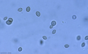 Queste sporangiospore unicellulari e ovoidali di <i> <b> Rhizopus stolonifer </b> </i> sono leggermente melanizzate.